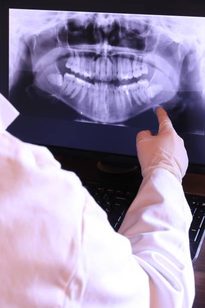 Best Knocked-Out Tooth Emergency  in Grenelefe, FL